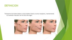 DEFINICION
Transporte de tejido desde un área dadora hasta un área receptora, manteniendo 
su conexión vascular con el sitio