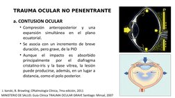 TRAUMA OCULAR NO PENENTRANTE
a. CONTUSION OCULAR
• Compresión 
anteroposterior 
y 
una 
expansión simultánea en el plano 
ecu