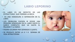LABIO LEPORINO
• EL 
LABIO 
ES 
UN 
DEFECTO 
DE 
LAS 
ESTRUCTURAS  QUE FORMAN LA BOCA.
•  ES UNA HENDIDURA O SEPARACIÓN EN EL