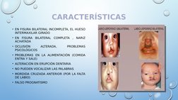 CARACTERÍSTICAS
• EN FISURA BILATERAL INCOMPLETA, EL HUESO 
INTERMAXILAR GIRADO 
• EN FISURA BILATERAL COMPLETA , NARIZ 
ACHA