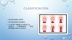 CLASIFICACIÓN
• EN PALADAR DURO
• EN PALADAR BLANDO
• A VECES ABARCA HASTA LA      
ÚVULA 
FORMANDO 
DOS 
MITADES DE LA ÚVULA