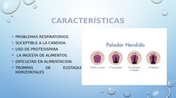 CARACTERÍSTICAS
• PROBLEMAS RESPIRATORIOS.
• SUCEPTIBLE A LA CANDIDA.
• USO DE PROTESISPARA
•  LA INGESTA DE ALIMENTOS.
• DIF