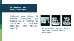 Hidróxido de calcio y 
resina compuesta
contienen
una
adición
de
material
radiopaco
que
proporciona
al
material
de
obturación