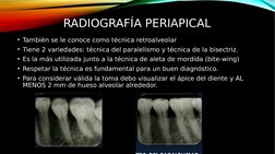 RADIOGRAFÍA PERIAPICAL
• También se le conoce como técnica retroalveolar
• Tiene 2 variedades: técnica del paralelismo y técn