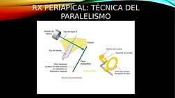 RX PERIAPICAL: TÉCNICA DEL 
PARALELISMO
