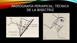 RADIOGRAFÍA PERIAPICAL: TÉCNICA 
DE LA BISECTRIZ
