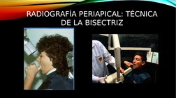 RADIOGRAFÍA PERIAPICAL: TÉCNICA 
DE LA BISECTRIZ
