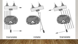 CT Scanner Generations Explained | PDF | Ct Scan | X Ray