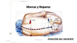 SITIOS MÁS COMUNES 
1
2
2
3
4
5
6
bloqueos del neuroeje
POSICIÓN DEL PACIENTE 
5/10/2019
7
