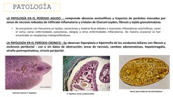 PATOLOGÍA
LA PATOLOGÍA EN EL PERÍODO AGUDO .- comprende abscesos eosinofílicos y trayectos de parásitos marcados por
zonas de