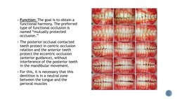 Function: The goal is to obtain a 
functional harmony. The preferred 
type of functional occlusion is 
named “mutually prote
