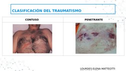 CLASIFICACIÓN DEL TRAUMATISMO
CONTUSO  
PENETRANTE
 
LOURDES ELENA MATTEOTTI 
DELGADO #27
