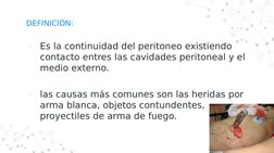 DEFINICIÓN:
-
Es la continuidad del peritoneo existiendo 
contacto entres las cavidades peritoneal y el 
medio externo. 
-
la