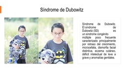 Síndrome de Dubowitz
Síndrome 
de 
Dubowitz. 
El síndrome 
de 
Dubowitz (SD) 
es 
un síndrome congénito 
múltiple 
poco 
frec