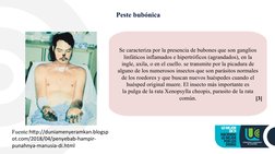 Peste bubónica
Fuente:http://duniamenyeramkan.blogsp
ot.com/2018/04/penyebab-hampir-
punahnya-manusia-di.html
Se caracteriza