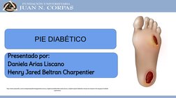 PIE DIABÉTICO 
Presentado por: 
Daniela Arias Liscano
Henry Jared Beltran Charpentier
http://www.siacardio.com/consejos/epide