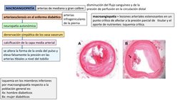 MACROANGIOPATÍA
arterias de mediano y gran calibre
arterioesclerosis en el enfermo diabético
neuropatía autonómica
denervació