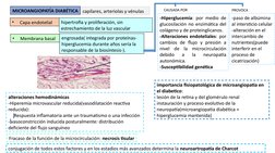 MICROANGIOPATÍA DIABÉTICA
•
Capa endotelial
•
Membrana basal
engrosada( integrada por proteínas-
hiperglucemia durante años s