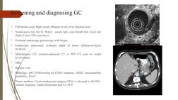 Screening and diagnosing GC

Full blood count, HgB, serum albumin levels, liver function tests

Noninvasive test for H. Pyl