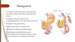Management

In stages I to III, resection is indicated and 
resectable if the tumor does not go beyond 
serosa

Complete su