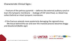 Characteristic Clinical Signs :
-  Fracture of the petrous pyramid      deforms the external auditory canal or 
tears the tym