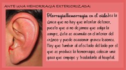 ANTE UNA HEMORRAGIA EXTERIORIZADA: Otorragia(hemorragia en el oído):
es la 
única que no hay que intentar detener, 
puesto qu