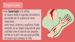 •Una hemorragia es la salida 
de sangre desde el aparato circulatorio, 
provocada por la ruptura de vasos 
sanguíneos 
como v
