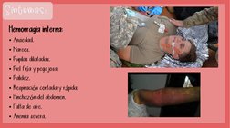 Hemorragia interna:
• Ansiedad.
• Mareos.
• Pupilas dilatadas.
• Piel fría y pegajosa.
• Palidez.
• Respiración cortada y ráp