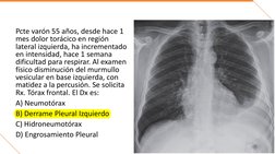 Pcte varón 55 años, desde hace 1 
mes dolor torácico en región 
lateral izquierda, ha incrementado 
en intensidad, hace 1 sem