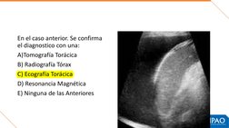 En el caso anterior. Se confirma 
el diagnostico con una:
A)Tomografía Torácica
B) Radiografía Tórax
C) Ecografía Torácica
D)