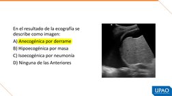En el resultado de la ecografía se 
describe como imagen:
A) Anecogénica por derrame
B) Hipoecogénica por masa
C) Isoecogénic