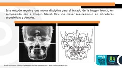 Este método requiere una mayor disciplina para el trazado de la imagen frontal, en 
comparación con la imagen lateral. Hay un
