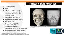 •
Crista galli (Cg)
•
ENA
•
Interincisivo Superior (A1)
•
Interincisivo inferior (B1)
•
Menton (Me)
•
Zigomaticorbitario (ZL/