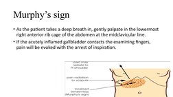 Understanding Murphy's Sign in Cholecystitis | PDF