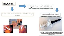  
Vain
Vaina de diámetro v
a de diámetro variable (3, 5, 10, 12 or
ariable (3, 5, 10, 12 or 15
15
mm
mm

laparoscop
laparosc