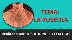 Realizado por: JOSUE RENGIFO LLACCTAS
TEMA: 
LA RUBEOLA
