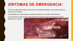 SÍNTOMAS DE EMERGENCIA:
Si el óvulo fecundado sigue creciendo en la trompa de Falopio, esto puede causar la 
ruptura de la tr