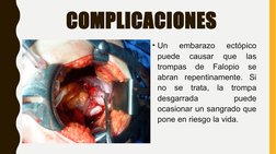 COMPLICACIONES 
• Un 
embarazo 
ectópico 
puede 
causar 
que 
las 
trompas 
de 
Falopio 
se 
abran repentinamente. Si 
no se