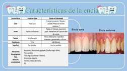Características de la encía
Características de la encía
Encía sana
Encía enferma
