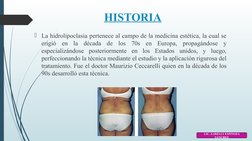 HISTORIA
La hidrolipoclasia pertenece al campo de la medicina estética, la cual se 
erigió en la década de los 70s en Europa