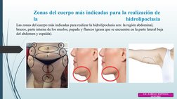 Zonas del cuerpo más indicadas para la realización de 
la 
hidrolipoclasia
 
Las zonas del cuerpo más indicadas para realizar