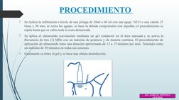 PROCEDIMIENTO 

Se realiza la infiltración a través de una jeringa de 20ml o 60 ml con una aguja  N#21 o una cánula 25 
Gaus