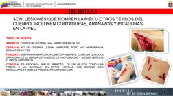 HERIDAS
SON  LESIONES QUE ROMPEN LA PIEL U OTROS TEJIDOS DEL 
CUERPO. INCLUYEN CORTADURAS, ARAÑAZOS Y PICADURAS 
EN LA PIEL.