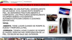 FRACTURA Y ESGUINCES
FRACTURA: ES UNA RUPTURA, GENERALMENTE 
EN UN HUESO. SI EL HUESO ROTO ROMPE LA 
PIEL, SE DENOMINA FRACTU