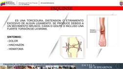 ESQUINSE
     ES UNA TORCEDURA, DISTENSION O ETIRAMIENTO 
EXCESIVO DE ALGUN LIGAMENTO. SE PRODUCE DEBIDO A 
UN MOVIMIENTO BRU