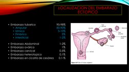 LOCALIZACION DEL EMBARAZO 
ECTOPICO
• Embarazo tubarico
95-98%
• Ampular
85-90%
• Istmico
5-10%
• Fimbrico
5%
• Intersticial