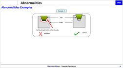 Tpm Defect Type 7 Types of TPM Abnormalities Explained | PDF | Belt (Mechanical) | Valve
