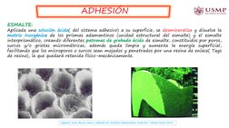 ESMALTE:
Aplicada una solución ácida( del sistema adhesivo) a su superficie, se desmineraliza y disuelve la
matriz inorgánica