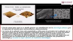• Cuando vemos estos casos es un desafío generar una rehabilitación con la odontología adhesiva y es 
la capacidad del esmalt