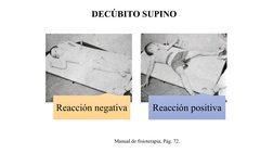DECÚBITO SUPINO  
Reacción negativa
Reacción positiva 
Manual de fisioterapia, Pág. 72. 
